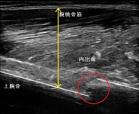 20140131181943_1824280douga.jpg